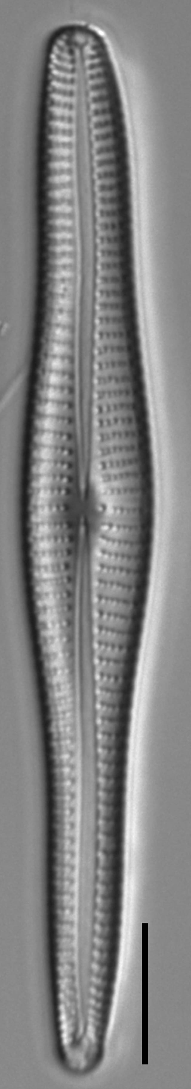 Gomphonema vibroides LM5