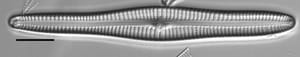 Gomphonema vibroides LM4