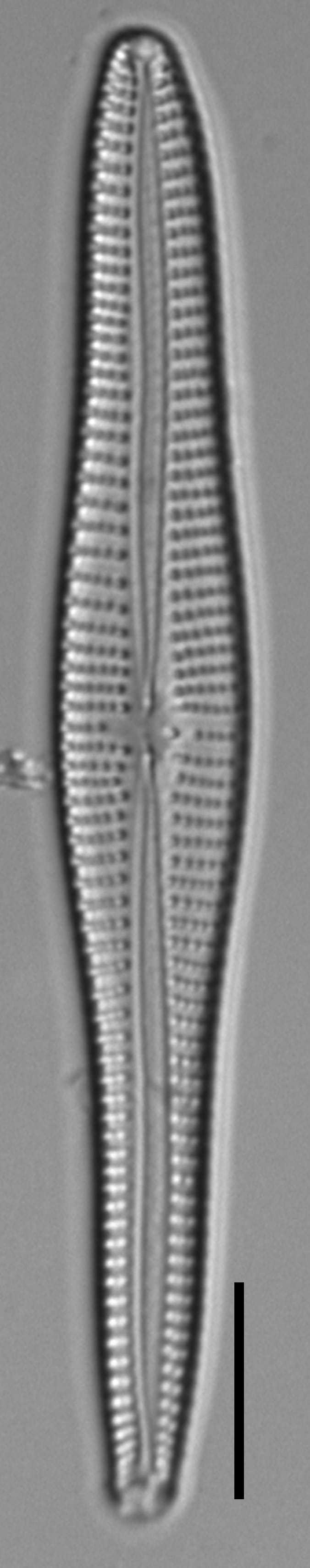 Gomphonema vibroides LM6