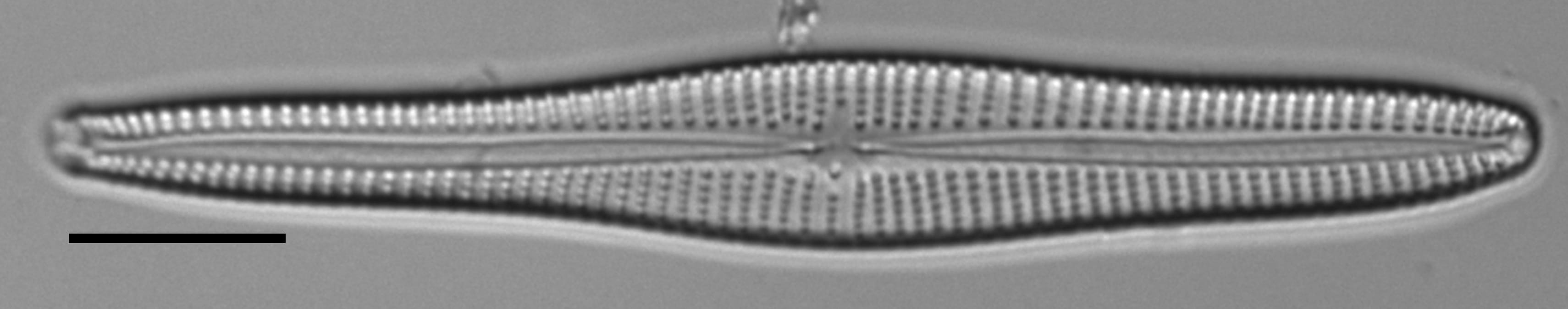 Gomphonema vibroides LM6