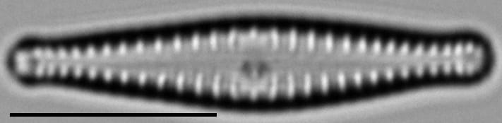 Gomphonema superiorense LM7