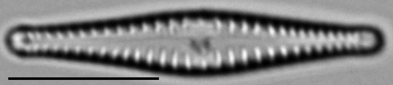 Gomphonema superiorense LM5