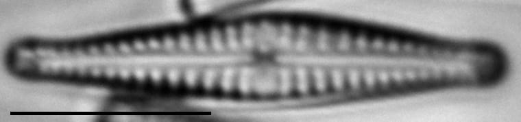 Gomphonema superiorense LM4