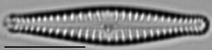 Gomphonema superiorense LM2