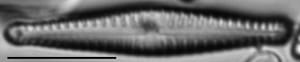 Gomphonema superiorense LM1