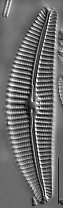 Cymbella subturgidula LM6