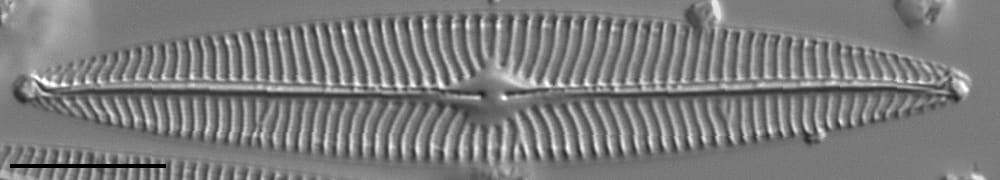 Navicula radiosa LM3