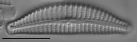 Cymbella excisifomis LM7