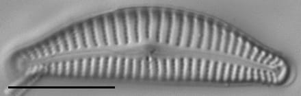 Cymbella excisifomis LM6