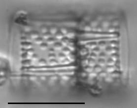 Aulacoseira muzzanensis LM4
