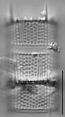 Aulacoseira muzzanensis LM5