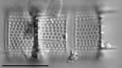 Aulacoseira muzzanensis LM5