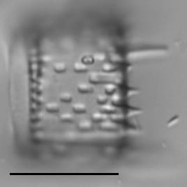 Aulacoseira muzzanensis LM6