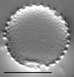 Aulacoseira muzzanensis LM7