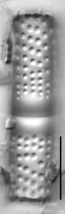 Aulacoseira crassipunctata LM3