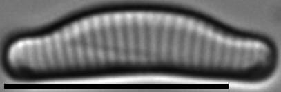 Eunotial tenella LM3