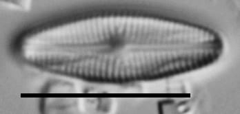 Genkalia Digitulus Cthp001 A 112117 68 C