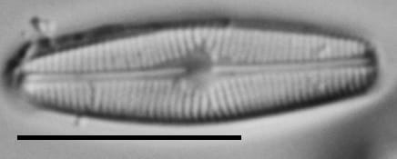 Genkalia Digitulus Me10009 C 101317 186