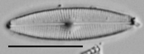 Genkalia Digitulus Me10010 A 102417 02 C