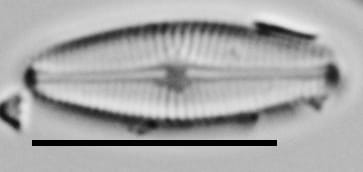 Genkalia Digitulus Me10023 A 101817 31 C