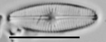 Genkalia Digitulus Me10023 A 101817 35 C