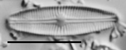 Genkalia Digitulus Nh10066 A 121117 11 C