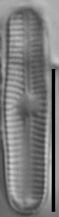 Genkalia digituloides LM5