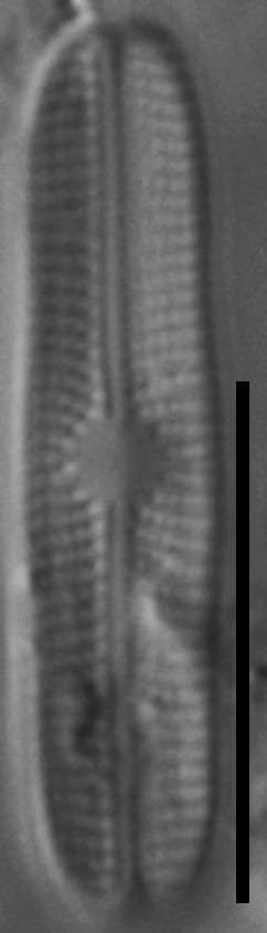 Genkalia digituloides LM1