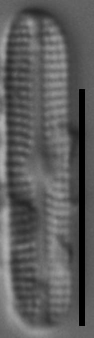 Genkalia digituloides LM7