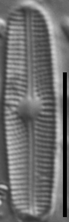 Genkalia digituloides LM3