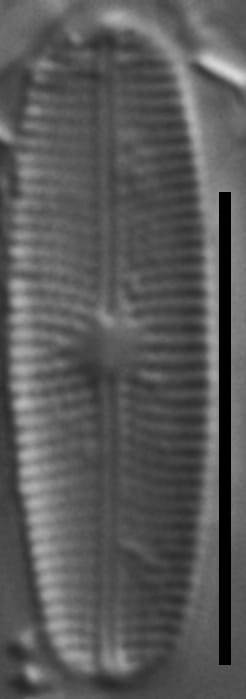 Genkalia digituloides LM4