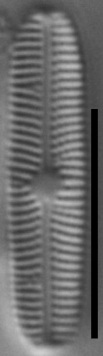 Genkalia digituloides LM2