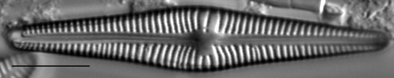 Gomphonema johnsonii LM1