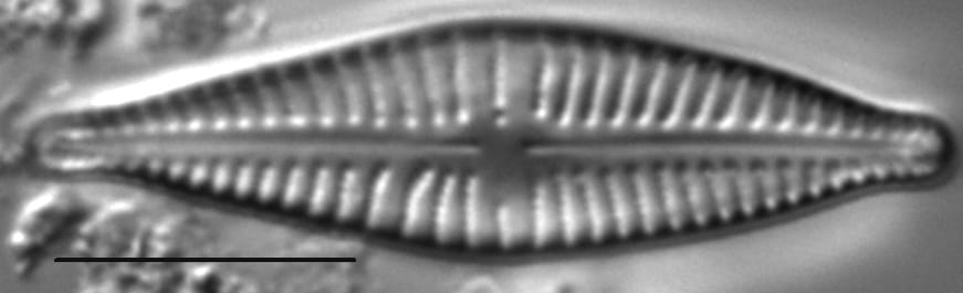 Gomphonema johnsonii LM5