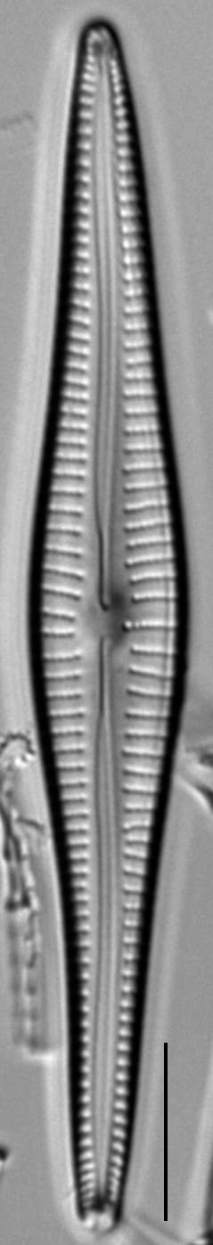 Gomphonema Intricatum Var Vibrio Lm6