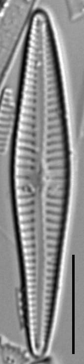 Gomphonema Intricatum Var Vibrio Lm7