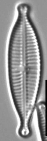 Gomphonema Lagenula LM2