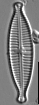 Gomphonema Lagenula LM3
