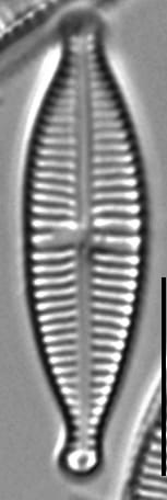Gomphonema Lagenula LM4