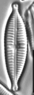 Gomphonema Lagenula LM5
