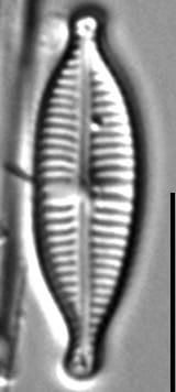 Gomphonema Lagenula LM7