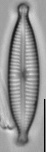 Gomphonema Lagenula LM1