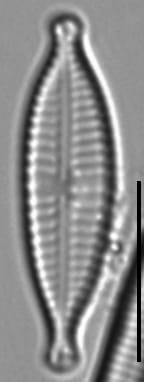 Gomphonema Lagenula LM6