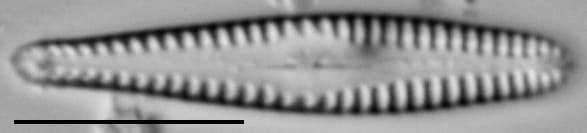Gomphonema sierranum LM3
