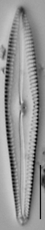 Gomphonema pointy LM3