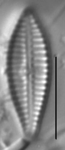 Gomphonema Consector LM7