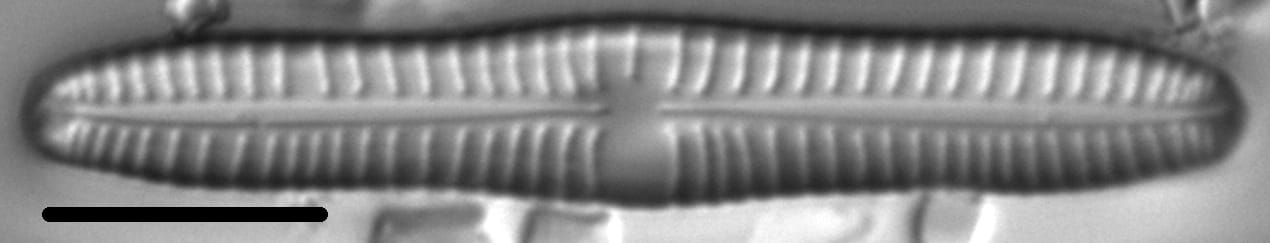 Gomphonema distans LM1