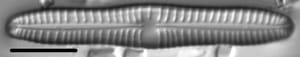 Gomphonema distans LM1