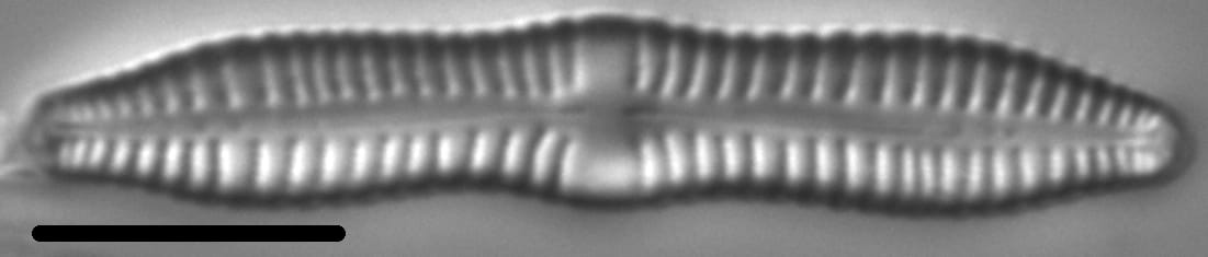 Gomphonema distans LM2