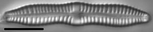 Gomphonema distans LM2